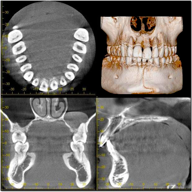 歯や顎の構造を分析 「CT（3次元立体画像）」
